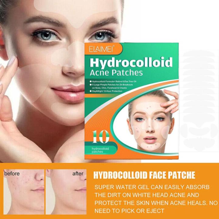 Hydrocolloid%20Acne%20Face%20Mask%20-%205%20Large%20Pimple%20Patches%20For%20Zit%20Breakouts%20On%20Nose,%20Chin,%20Forehead%20And%20Cheeks%2010pcs/box%20R7L7%20-%20Image%202