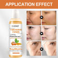118ml Tumeric Dark Spots Toner Spots Eraser Corrector Turmeric Fade Blemishes Dark Spot Remover Acne Remover Toner for Dark Skin.