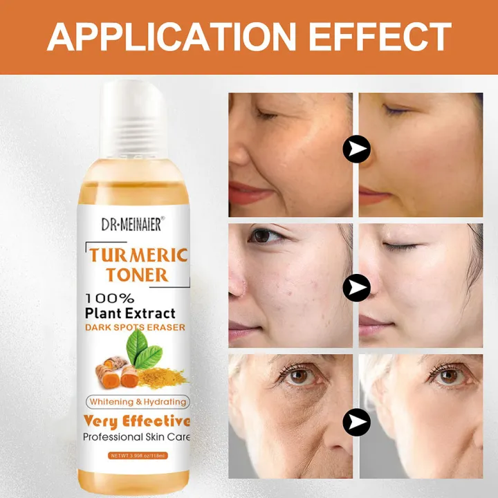 118ml%20Tumeric%20Dark%20Spots%20Toner%20Spots%20Eraser%20Corrector%20Turmeric%20Fade%20Blemishes%20Dark%20Spot%20Remover%20Acne%20Remover%20Toner%20for%20Dark%20Skin%20-%20Image%204