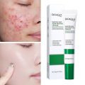 BIOAQUA Natural Salicylic Acid for Acne Face Cream Cleaning Pores Repairing Acne Spots Controlling Moisturizing Skin Remove Acne Marks-20gm.
