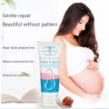 Aichun Beauty Anti Stretch Mark Scar Removal Cream. 