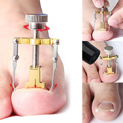Manicure%20Set%20Nail%20Care%20machine%20for%20nail%20repair%20Pedicure%20Correction%20Tool%20Foot%20Correcting%20Device%20Ingrown%20Toenail%20Fixer%20Toe%20nail%20Recover%20-%20Image%206