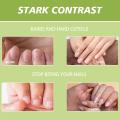Nail Cuticle Oil for Nails Oil Treatment for Damaged Nails Cuticle Repair Jojoba Oil Nails Care Strengthener Nail Oil Cuticle. 