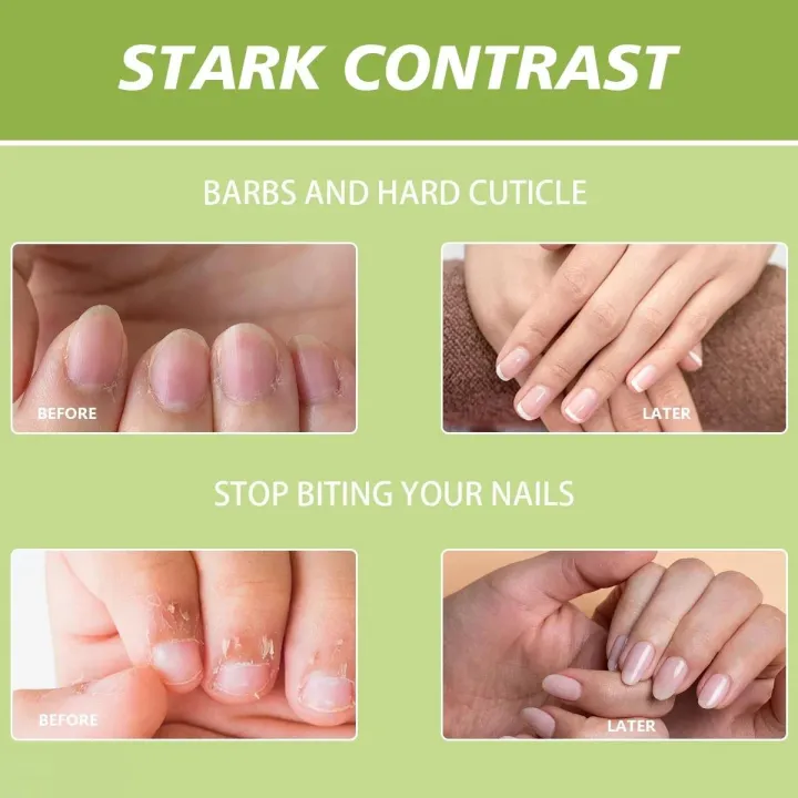 Nail%20Cuticle%20Oil%20for%20Nails%20Oil%20Treatment%20for%20Damaged%20Nails%20Cuticle%20Repair%20Jojoba%20Oil%20Nails%20Care%20Strengthener%20Nail%20Oil%20Cuticle%20-%20Image%203