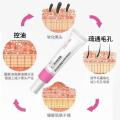 Azelaic acid gel 15% salicylic acid combination acne cream to remove acne blackheads and fade acne.