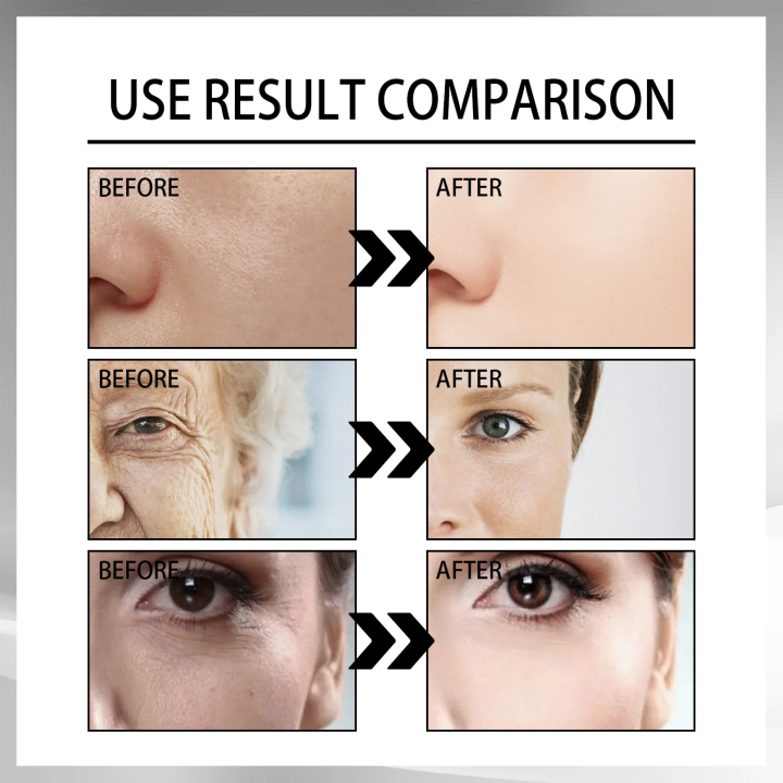 Anti%20Wrinkle%20Cream%20Snail%20Serum%20Face%20Moisturizer%20Anti%20Aging%20Face%20Lifting%20Nourishing%20Repair%20Snail%20Cream%20Korean%20Original%20Essence%20-%20Image%206