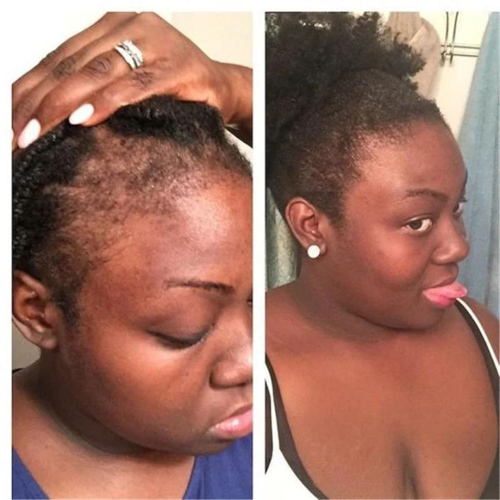 Hair%20Shampoo%20For%20Fast%20Hair%20Growth%20Rosemary%20Onion%20Hair%20Regrowth%20Shampoo%20Anti%20Hair%20Loss%20Effective%20Within%207%20Day%20Hair%20Growth%20Product%20-%20Image%204