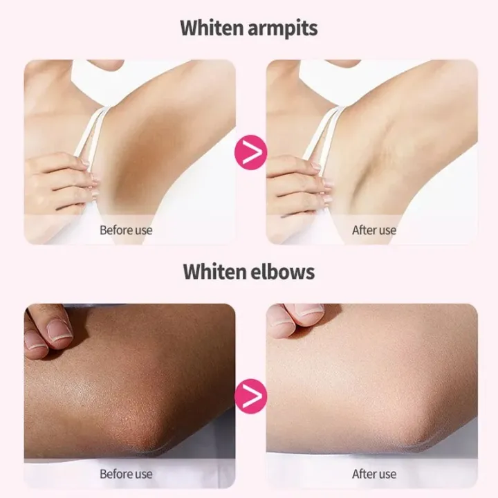 Intimate%20Area%20Whitening%20Cream%20Pink%20Body%20Serum%20Lighten%20Melanin%20Underarms%20Hips%20Inner%20Thighs%20Brightening%20Repair%20Private%20Part%20Care%20-%20Image%204
