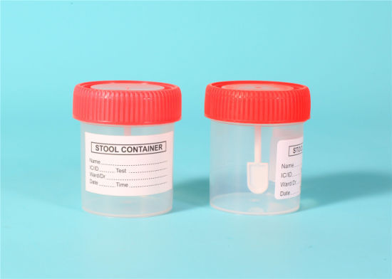 70%20Pcs%20%20STOOL%20Sample%20Collection%20Plastic%20Tube%20%20Container%20For%20Home,%20Hospital%20&%20Laboratory%20Use%20-%20Image%202