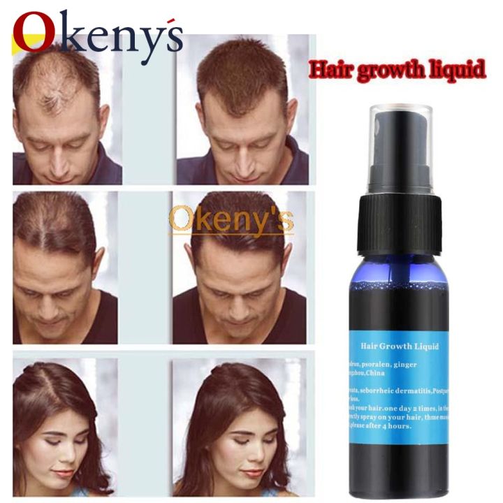 4pcs%2030ml%20Ginger%20Hair%20Growth%20Spray%20Yuda%20Pilatory%20Faster%20Hair%20Growth%20Products%20for%20Men%20and%20Woman%20Special%20for%20Postpartum%20Hair%20Loss%20-%20Image%202