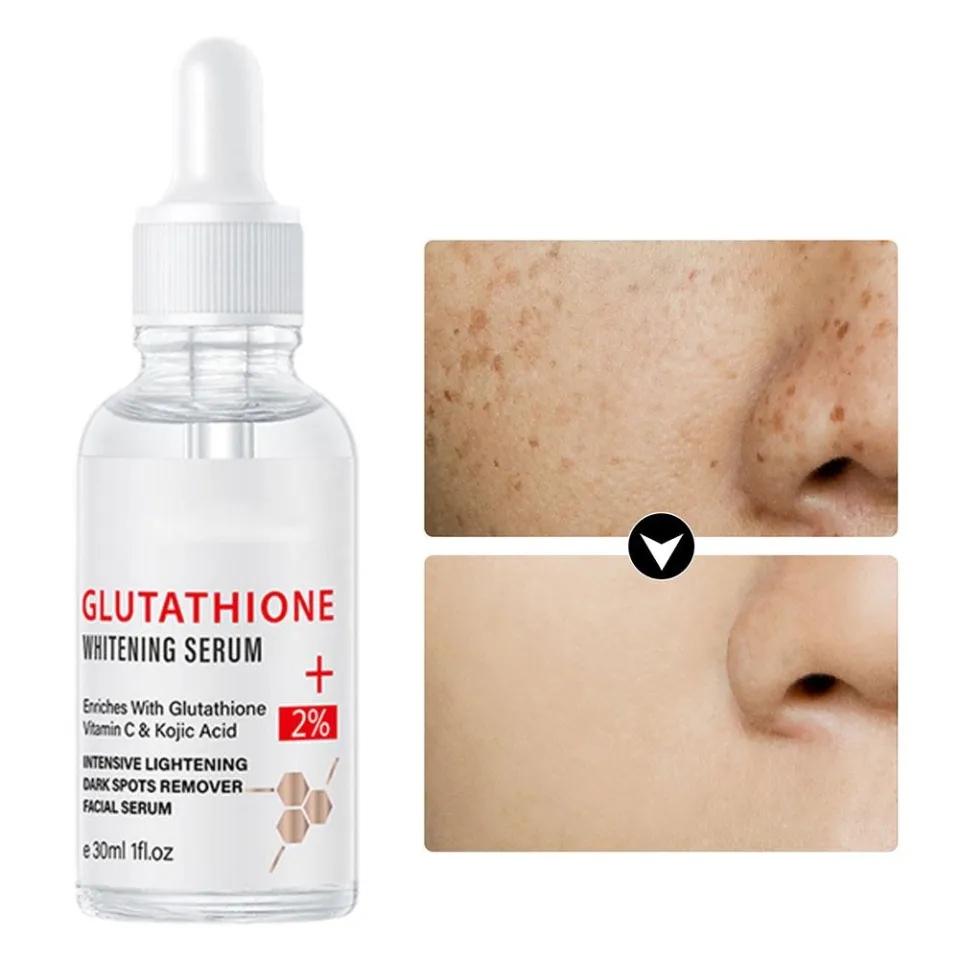 glutathione and drinking Glutathione Whitening Freckle Serum Remove Melasma Dark Serum Whitening C  Nicotinamide Spots Kojic Face Acid With Vitamin M7U8