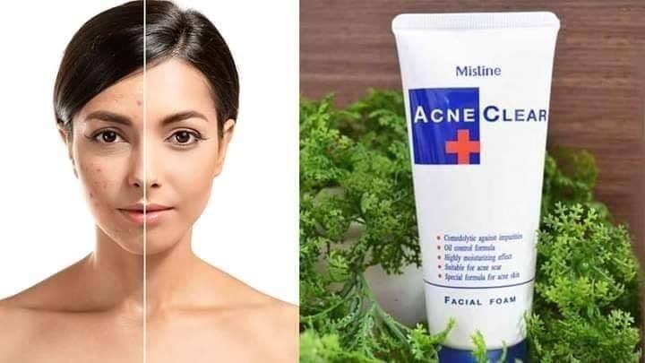 Mistine%20Acne%20Clear%20Facial%20Foam%20Face%20Wash%2085gm%20%7C%20Thailand%20-%20Image%206