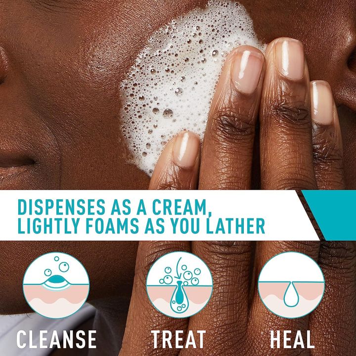 Cerave%20Acne%20Foaming%20Cream%20Cleanser%20150ml%20-%20Image%204