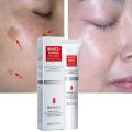 Whitening Freckle Cream Effective Remove Melasma Cream Remove Dark Spots Melanin Moisturize Brighten Smooth Face Skin Care.