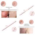 Blackhead Remover Pimple Comedone Extractor Tool Best Acne Removal Kit - Treatment for Blemish, Whitehead Popping, Zit Removing for Risk Free Nose Face Skin with Case. 