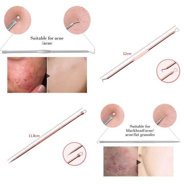 Blackhead%20Remover%20Pimple%20Comedone%20Extractor%20Tool%20Best%20Acne%20Removal%20Kit%20-%20Treatment%20for%20Blemish,%20Whitehead%20Popping,%20Zit%20Removing%20for%20Risk%20Free%20Nose%20Face%20Skin%20with%20Case%20-%20Image%203