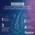 Female Minoxidil Rogaine Topical Solution Hair Regrowth Treatment 2% Minoxidil for Women - 60 ml 30 Days Supply with Derma Roller Combo - MNXWC. 