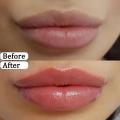 4/6/8 Pieces Set Vaseline Lip Balm Moisturizing Lip Mask Repairing Lips for Men and Women Fade Lip Lines Korea Lip Cream. 
