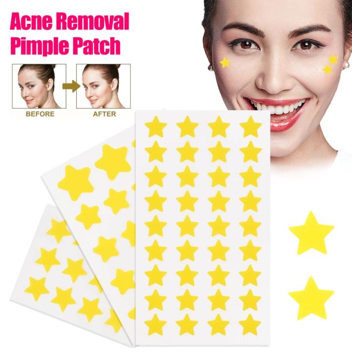 Star%20Acne/Pimple%20Patch,%20Yellow%20Star%20Shaped%20Acne%20Absorbing%20Cover%20Patch,%20Invisible%20Hydrocolloid%20Acne%20Patches%20For%20Face%20Acne%20Dots%20FeeoiF%20-%20Image%206