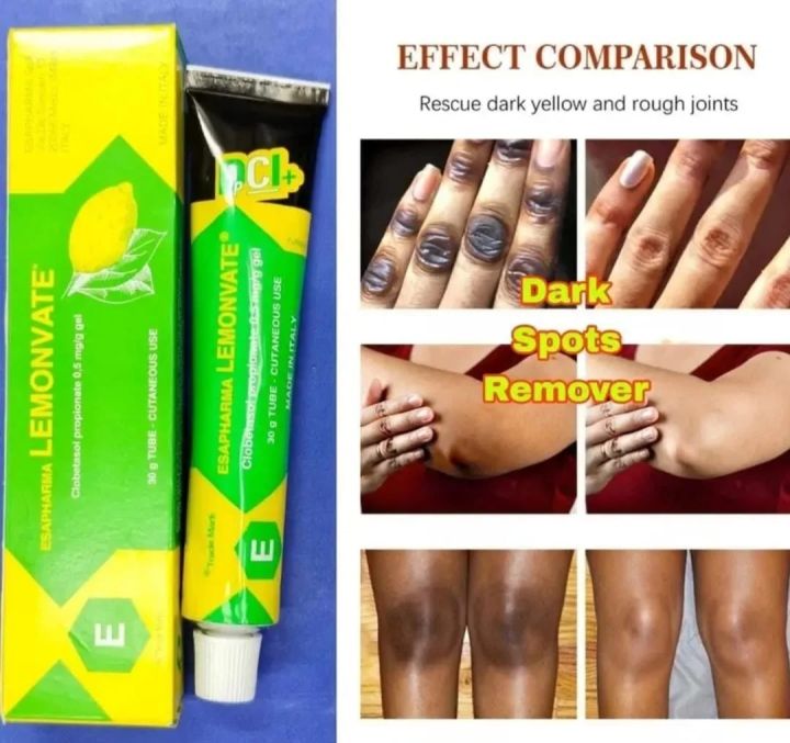 Esapharma%20LemonVate%20Cream%20For%20Skin%20Whitening%2030g%20-%20Image%205