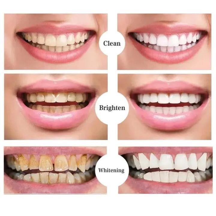 ELHOE%20Teeth%20Whitening%20Toothpaste%20%E2%80%93%20100%25%20Natural%20Herbal%20Formula%20%E2%80%93%20Instantly%20Whitens%20Teeth,%20Removes%20Yellow%20Stains,%20Fights%20Plaque%20&%20Bad%20Breath%20%E2%80%93%20Strengthens%20Enamel%20%E2%80%93%20Fluoride-Free%20&%20Safe%20for%20Sensitive%20Gums%20%E2%80%93%20Daily%20Oral%20Care%20Toothpaste%20for%20Men%20&%20Women%20-%20Image%202