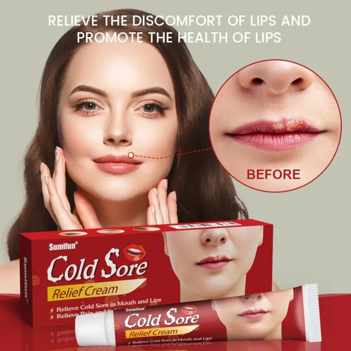 20g%20Cold%20Sores%20Lip%20Care%20Cream%20Repair%20Cheilitis%20Lips%20Herpes%20Ulceration%20Antibacterial%20Ointment%20Moisturizing%20Lip%20Balm%20-%20Image%203