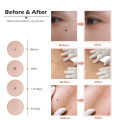 LCD Plasma Removal Pen Face Wart Freckle Remover Machine Mole Dark Spot Skin Tag Removal 9 Level USB Charge Beauty Salon. 