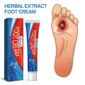 Diabetes Treatment Foot Cream Repair Feet Ulceration Relieve Itchy Improve Heel Cracking Nourishing Blood Sugar Care Ointment. 