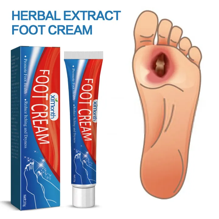 Diabetes%20Treatment%20Foot%20Cream%20Repair%20Feet%20Ulceration%20Relieve%20Itchy%20Improve%20Heel%20Cracking%20Nourishing%20Blood%20Sugar%20Care%20Ointment%20-%20Image%203