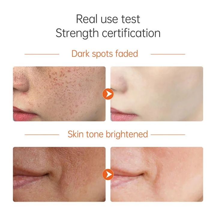 JoyPretty%20Vitamin%20C%20Face%20Whitening%20Skin%20Care%20Set%20Glowing%20Dark%20Spots%20Remover%20Cream%20Serum%20Deep%20Cleaning%20Toner%20Facial%20Skincare%20Kits%20-%20Image%203