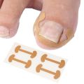 20-100pcs Professional Ingrown Toenail Foot Corrector Stickers Elasticity Toe Nail Care Pedicure Tools Toe Health Care Protects.