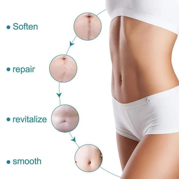 1%20Roll%20Surgery%20Scar%20Removal%20Silicone%20Gel%20Sheet%20Patch%20Tape%20Sticker%20Skin%20Repair%20-%20Image%205