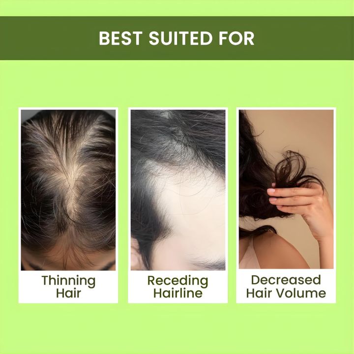 Alps%20Goodness%20Rosemary%20Water%20For%20Hair%20Growth%20%7C%20Hair%20Spray%20for%20Regrowth%20200ml%20-%20Image%207