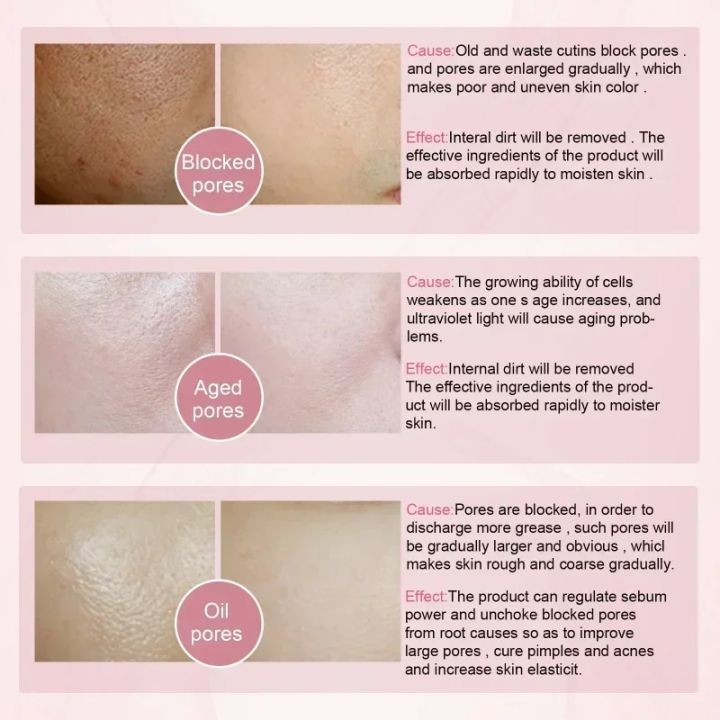 30ML%20Pore%20Base%20Face%20Primers%20Magical%20Perfecting%20Under%20Foundation%20Shrink%20Cream%20Personal%20Cosmetics%20Make%20Up%20Moisturize%20the%20skin%20Loser%20Lione%20-%20Image%206
