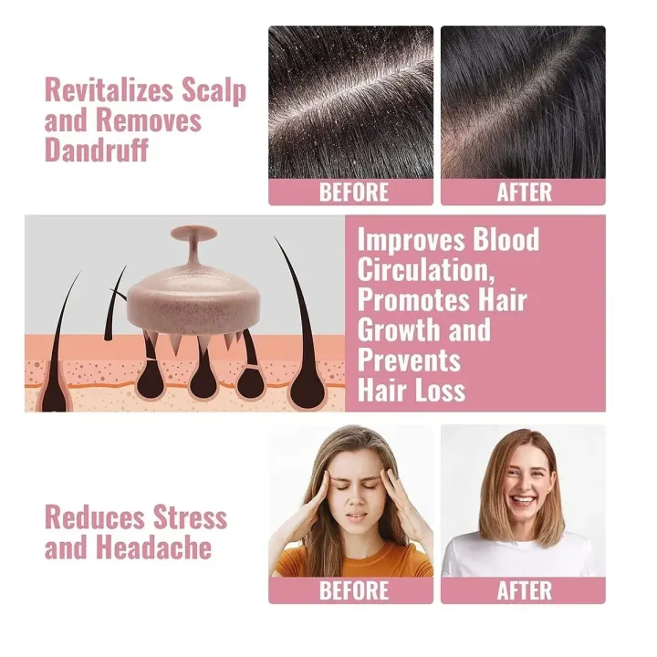 High-quality%20Silicone%20Shampoo%20Brush%20/%20Hair%20Scalp%20Massage%20Brush%20Silicone%20Hair%20Care%20Hair%20brushes%20combs%20-%20Image%205