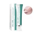 Effective Recovery Scar Cream Fast Removal Surgery Scars Healing Stretch Marks Acne Pox Prints Repair Smooth Whitening Skin Care.
