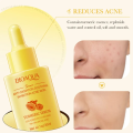 BIOAQUA Turmeric Facial Serum Anti-Oxidation Soothing Acne Skin Hyaluronic Acid Control Oil Moisturizing Face Skin 30ml. 