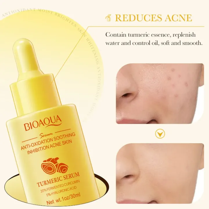 BIOAQUA%20Turmeric%20Facial%20Serum%20Anti-Oxidation%20Soothing%20Acne%20Skin%20Hyaluronic%20Acid%20Control%20Oil%20Moisturizing%20Face%20Skin%2030ml%20-%20Image%203