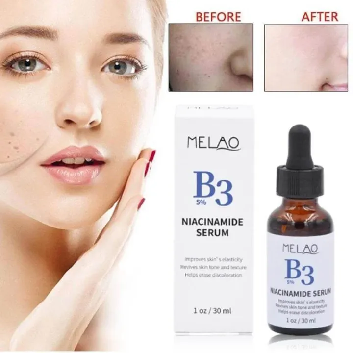 MELAO%20B3%205%25%20Niacinamide%20Serum%20-%2030ml%20-%20Image%202