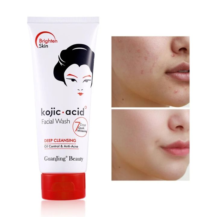 Kojic Acid Facial Cleanses Deep Cleansing Skin Care Korean Wash Face With Foam Moisturizing Fix Dark Spots Brighten Skin 100g