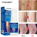 Varicose Vein Treatment Spray Vasculitis Phlebitis Spider Relief Fatigue Leg Dilation Pain Herbal Beauty Body Skin Care 30ml. 