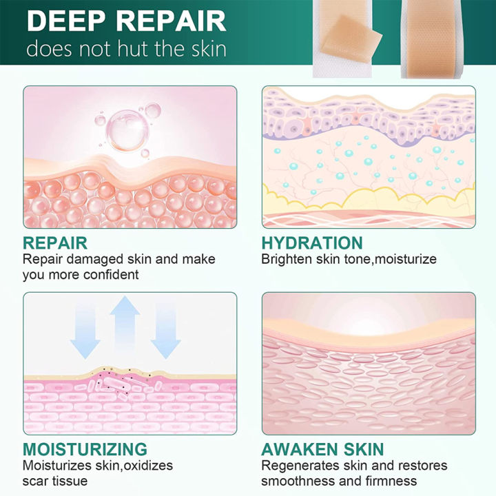1%20Roll%20Efficient%20Beauty%20Self-Adhesive%20Silicone%20Gel%20Tape%20Removal%20Scar%20Tape%20Therapy%20Patch%20for%20Acne%20Trauma%20Burn%20Scar%20Skin%20Repair%20-%20Image%205