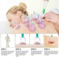 Hijama/Cupping/Sunnah Therapy 1 set with 32 pcs cup. 