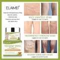 Varicose Veins Cream.