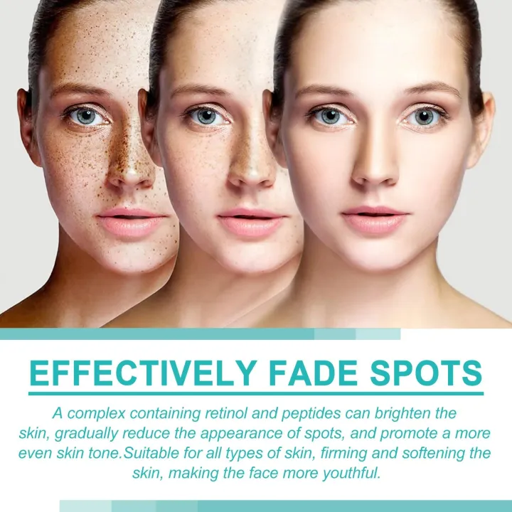 EELHOE%20Dark%20Spot%20Remover%20Cream%20Melasma%20Correction%20Freckle%20Removing%20Anti-Aging%20Brightening%20Freckles%20Anti%20Wrinkle%20Whitening%20Cream%20-%20Image%206