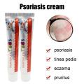 15g Chinese Medicine Psoriasis Ointment Treat Fungal Dermatitis Antipruritic Dressing Skim Eczema Antibacterial Repair Ointment. 
