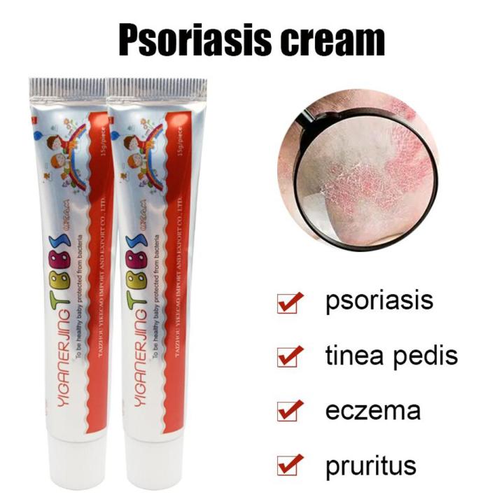 15g Chinese Medicine Psoriasis Ointment Treat Fungal Dermatitis Antipruritic Dressing Skim Eczema Antibacterial Repair Ointment