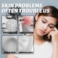 Effective Facial Redness Repair Cream Rosacea Treat Sensitive Skin Dryness Moisturizer Hydrating Sooth Lotion Korean Cosmetics.