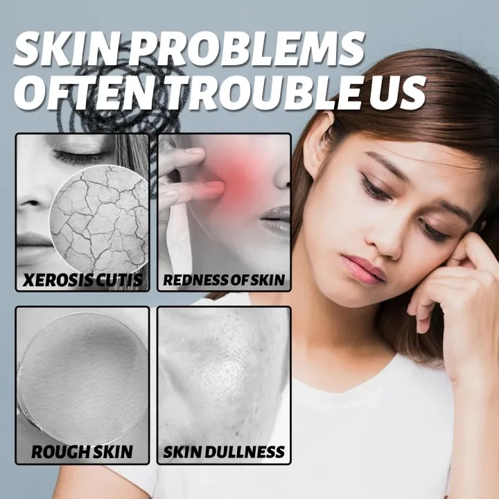 Effective%20Facial%20Redness%20Repair%20Cream%20Rosacea%20Treat%20Sensitive%20Skin%20Dryness%20Moisturizer%20Hydrating%20Sooth%20Lotion%20Korean%20Cosmetics%20-%20Image%204