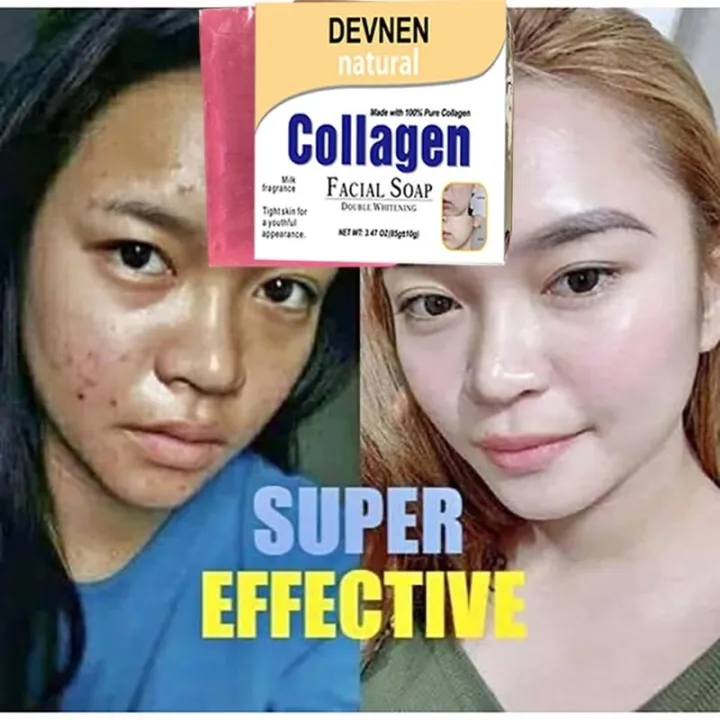 DEVNEN%20Natural%20Collagen%20Facial%20Soap%20Double%20Whitening%20-%20Image%202